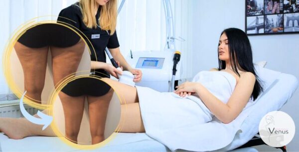 6x MED CONTOUR i 6x VIBROSAUNA SA DETOX TRETMANOM - DO 2,5 CM MANJE već nakon...