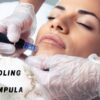 MICRONEEDLING - vratite sjaj i pomladite svoju kožu uz poznatu nekiruršku<br>...