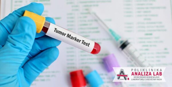 Tumorski marker za žene ili muškarce - otkrijte tumor na vrijeme<br> u Polikl...
