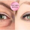 Vistabel 12 jedinica i 0.5 ml svjetski poznatog Restylane filera - najučinkov...
