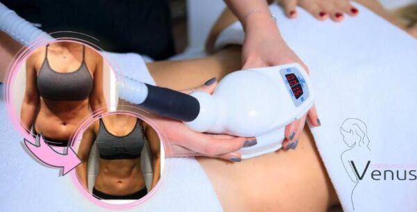 Smršavite uz NAJBOLJE APARATE NA TRŽIŠTU! Istopite masnoće uz <br>Med2Contour...