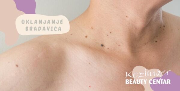Bezbolno uklonite 1 ili do 10 bradavica, fibroma i keratoza <br>PLASMA PEN tr...